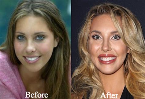 chloe lattanzi young|chloe lattanzi before after.